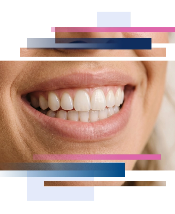 Close-up of a woman's smiling mouth showing white teeth and soft lips.